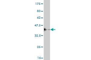 Western Blot detection against Immunogen (36. (ASCL1 Antikörper  (AA 137-236))