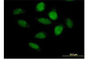 Immunofluorescence of purified MaxPab antibody to APBB3 on HeLa cell. (APBB3 Antikörper  (AA 1-486))