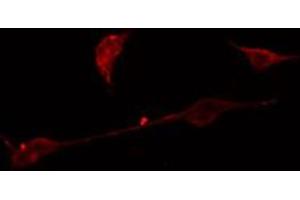 ABIN6275050 staining A549 cells by IF/ICC. (AGBL4 Antikörper  (C-Term))