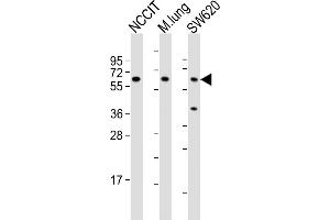Western Blotting (WB) image for anti-Transforming Growth Factor, beta Receptor II (70/80kDa) (TGFBR2) (AA 13-40), (N-Term) antibody (ABIN655799)