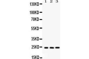 Western Blotting (WB) image for anti-BCL2-Associated Athanogene 2 (BAG2) (AA 1-211) antibody (ABIN3043508) (BAG2 Antikörper  (AA 1-211))