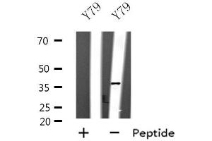 Western blot analysis of extracts of Y79 cell lines, using SPARC antibody. (SPARC Antikörper  (Internal Region))