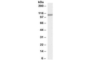 Western blot testing of human pancreas lysate with SMEK1 antibody at 0. (SMEK1 Antikörper)