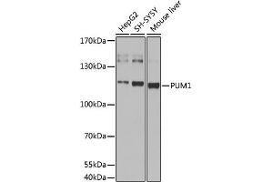 Western blot analysis of extracts of various cell lines, using pum1 antibody (ABIN6293483) at 1:1000 dilution. (PUM1 Antikörper)