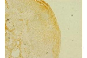 Immunohistochemistry of paraffin-embedded human skin tissue using ABIN7157698 at dilution of 1:100 (KREMEN1 Antikörper  (AA 180-380))