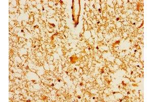 Immunohistochemistry of paraffin-embedded human brain tissue using ABIN7159356 at dilution of 1:100 (MAGI2 Antikörper  (AA 1308-1455))