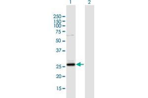 Western Blot analysis of CSN1S1 expression in transfected 293T cell line by CSN1S1 MaxPab polyclonal antibody.
