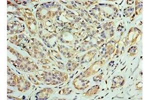 Immunohistochemistry (IHC) image for anti-DnaJ (Hsp40) Homolog, Subfamily C, Member 2 (DNAJC2) (AA 1-140) antibody (ABIN7150549)