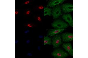 ABIN6260075 and ABIN6272255 staining  cells by IF/ICC.