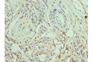 Immunohistochemistry of paraffin-embedded human epityphlon tissue using ABIN7169786 at dilution of 1:100 (SLAMF7 Antikörper  (AA 23-226))