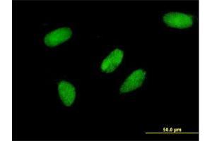 Immunofluorescence of monoclonal antibody to TCEA3 on HeLa cell. (TCEA3 Antikörper  (AA 1-348))