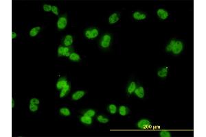 Immunofluorescence of monoclonal antibody to MED31 on HeLa cell. (MED31 Antikörper  (AA 1-131))