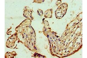Immunohistochemistry of paraffin-embedded human placenta tissue using ABIN7143011 at dilution of 1:100 (PHAP1 Antikörper  (AA 1-170))