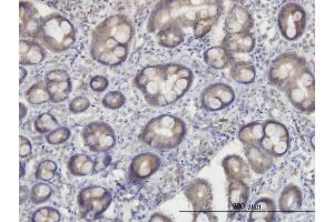Immunoperoxidase of monoclonal antibody to OXSR1 on formalin-fixed paraffin-embedded human small Intestine. (OXSR1 Antikörper  (AA 1-527))