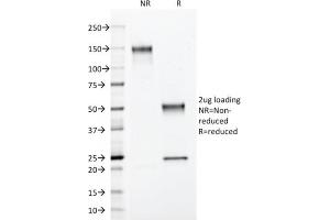SDS-PAGE (SDS) image for anti-Annexin A1 (ANXA1) antibody (ABIN6939608)