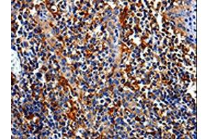 The image is immunohistochemistry of paraffin-embedded Human tonsil tissue using ABIN7129010(COX16 Antibody) at dilution 1/50. (COX16 Antikörper)