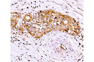 IHC analysis of AGPAT2 using anti-AGPAT2 antibody (ABIN7602435). (AGPAT2 Antikörper  (AA 77-178))