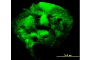 Image no. 5 for anti-3'-phosphoadenosine 5'-phosphosulfate Synthase 2 (PAPSS2) (AA 513-613) antibody (ABIN598592) (PAPSS2 Antikörper  (AA 513-613))