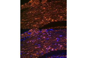 Immunofluorescence analysis of rat rectum using Calponin Rabbit mAb (ABIN1678670, ABIN3018018, ABIN3018019 and ABIN7101568) at dilution of 1:100 (40x lens). (CNN1 Antikörper)