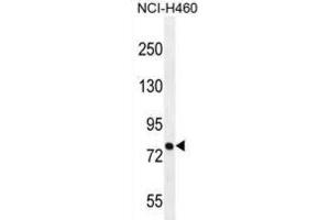 Western Blotting (WB) image for anti-Pinin, Desmosome Associated Protein (PNN) antibody (ABIN2996252) (PNN Antikörper)