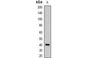 Western blot analysis of ABO expression in K562 (A) whole cell lysates. (ABO Antikörper)