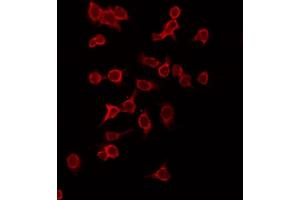ABIN6269133 staining HepG2 by IF/ICC. (KIT Antikörper  (Internal Region))