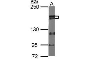 WB Image Sample (20 ug of whole cell lysate) A: human ESC 5% SDS PAGE antibody diluted at 1:1000 (ZMYM2 Antikörper  (Center))