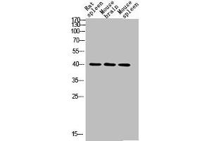 Western blot analysis of RAT-SPLEEN MOUSE-BRAIN MOUSE-SPLEEN lysis using CD72 antibody. (CD72 Antikörper  (Internal Region))