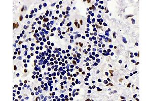 Immunohistochemistry (Paraffin-embedded Sections) (IHC (p)) image for anti-c-Fos (c-Fos) antibody (ABIN7249706)