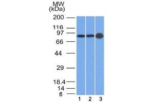 Western blot testing of human 1) U87, 2) HeLa and 3) A431 cell lysate with Plakophilin 1 antibody (clone 10B2). (Plakophilin 1 Antikörper  (N-Term))