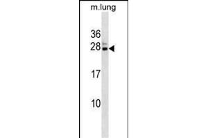 Mouse Cbx5 Antibody (C-term) (ABIN1536755 and ABIN2838240) western blot analysis in mouse lung tissue lysates (35 μg/lane). (CBX5 Antikörper  (C-Term))