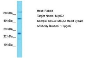Image no. 1 for anti-Mitochondrial Ribosomal Protein L22 (MRPL22) (AA 91-140) antibody (ABIN6750491) (MRPL22 Antikörper  (AA 91-140))