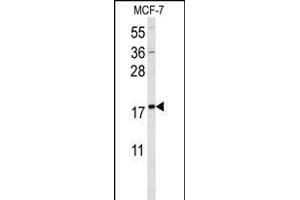 Western blot analysis of SUMO1 Antibody f in MCF-7 cell line lysates (35 μg/lane). (SUMO1 Antikörper)