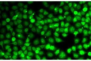 Immunofluorescence analysis of MCF7 cells using CCNE2 Polyclonal Antibody (Cyclin E2 Antikörper)