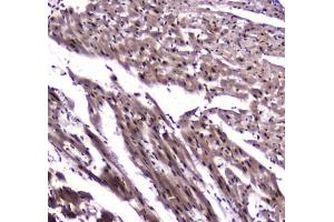 IHC testing of FFPE rat heart tissue with NFIB antibody at 1ug/ml. (NFIB Antikörper)