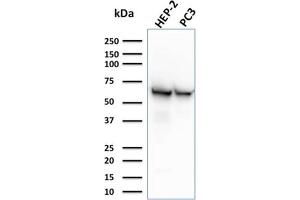 Western Blot Analysis of HEP-2 and PC3 cell lysates using HSP60 Mouse Monoclonal Antibody (CPTC-HSPD1-1). (HSPD1 Antikörper)