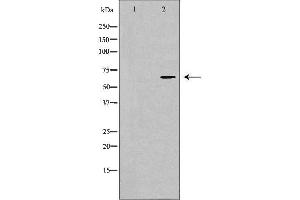 Western blot analysis of Jurkat whole cell lysates, using PTH1R Antibody. (PTH1R Antikörper  (pThr1))
