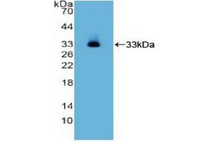 Western blot analysis of recombinant Human ITGa2. (ITGA2 Antikörper  (AA 678-894))