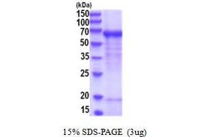 SDS-PAGE (SDS) image for Dopamine beta-Hydroxylase (Dopamine beta-Monooxygenase) (DBH) (AA 40-617) protein (His tag) (ABIN5854164) (DBH Protein (AA 40-617) (His tag))