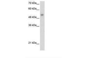 Image no. 1 for anti-One Cut Homeobox 3 (ONECUT3) (AA 374-423) antibody (ABIN203289) (ONECUT3 Antikörper  (AA 374-423))