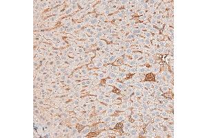 DF6386 at 1/200 staining mouse liver tissue sections by IHC-P.