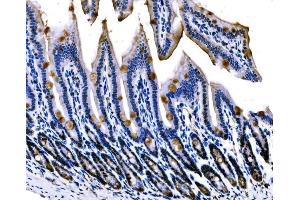 IHC analysis of Sigma1-Receptor/SIGMAR1 using anti-Sigma1-Receptor/SIGMAR1 antibody (ABIN7599011). (SIGMAR1 Antikörper  (AA 1-154))