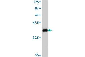 Western Blot detection against Immunogen (37. (ADAM2 Antikörper  (AA 376-475))