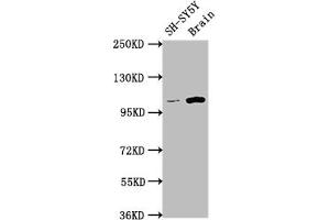 Western Blot Positive WB detected in: SH-SY5Y whole cell lysate, Rat brain tissue All lanes: LGR5 antibody at 1:1500 Secondary Goat polyclonal to rabbit IgG at 1/50000 dilution Predicted band size: 100, 98, 93 kDa Observed band size: 100 kDa (Rekombinanter LGR5 Antikörper)