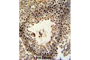 Immunohistochemistry (IHC) image for anti-PHD Finger Protein 13 (PHF13) antibody (ABIN3002222) (PHF13 Antikörper)