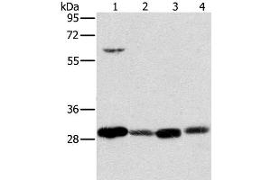 Western Blot analysis of 293T cell and Human testis tissue, A375 cell and Human normal kidney tissue using MRPL28 Polyclonal Antibody at dilution of 1:600 (MRPL28 Antikörper)