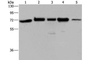 Western Blot analysis of A172, Hela and 293T cell, K562 cell and Human testis tissue using AGFG1 Polyclonal Antibody at dilution of 1:727 (AGFG1 Antikörper)