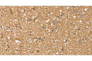 Immunohistochemistry of paraffin-embedded Human brain tissue using SDC3 Polyclonal Antibody at dilution 1:45 (SDC3 Antikörper)