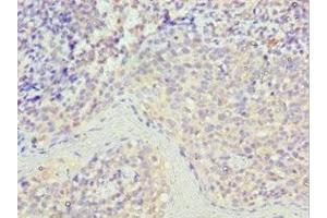 Immunohistochemistry of paraffin-embedded human tonsil tissue using ABIN7168977 at dilution of 1:100