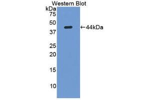 Western Blotting (WB) image for anti-Lumican (LUM) (AA 19-338) antibody (ABIN1174709) (LUM Antikörper  (AA 19-338))